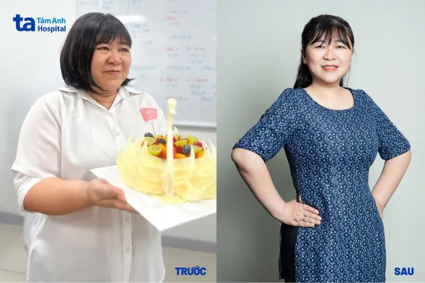 chị loan hết gan nhiễm mỡ sau giảm cân